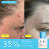 ZIIP Clear Salicylsäure-Serum