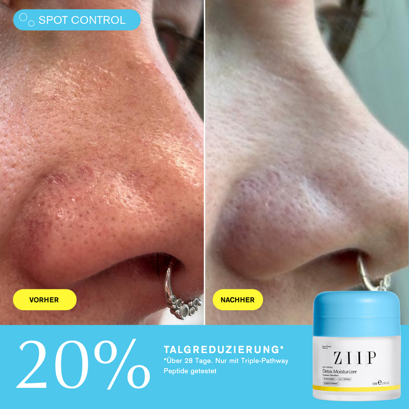ZIIP Detox Feuchtigkeitscreme + Niacinamid