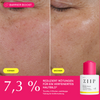 ZIIP Refresh Tranexamsäure-Serum