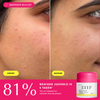 ZIIP Repair Feuchtigkeitscreme + Ceramide