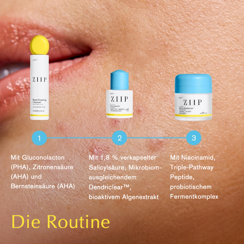 Spot Control Komplett-Routine